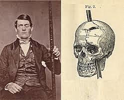 El caso de Phineas Gage