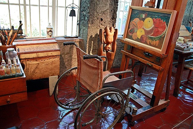 Amputan su pierna derecha