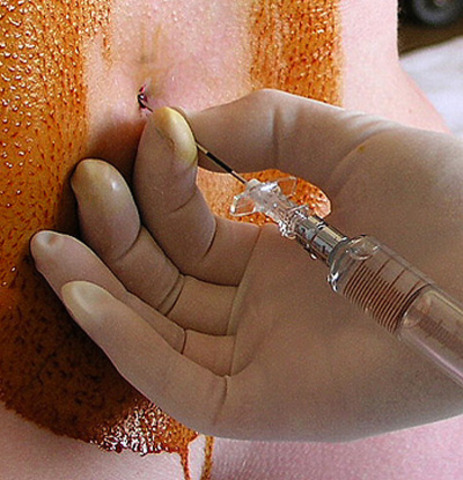 Scheduled C-section Birth, 8 am