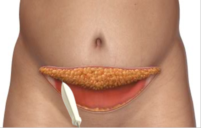 Cutting through... 8:09 am