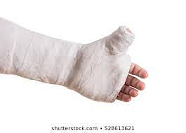 Fracturada por primera vez