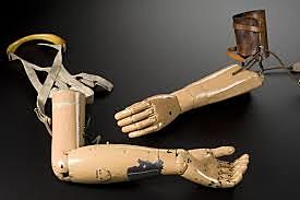 Carbon Fiber Prosthetic Limbs