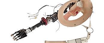 First Bionic Arm