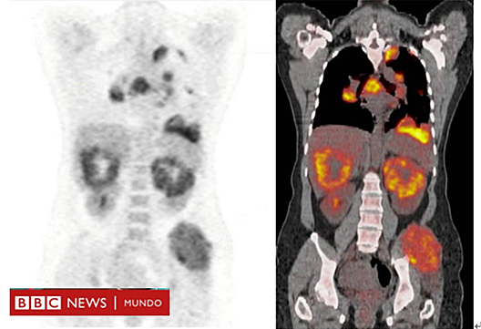 Muerte masiva en zonas costeras del mundo