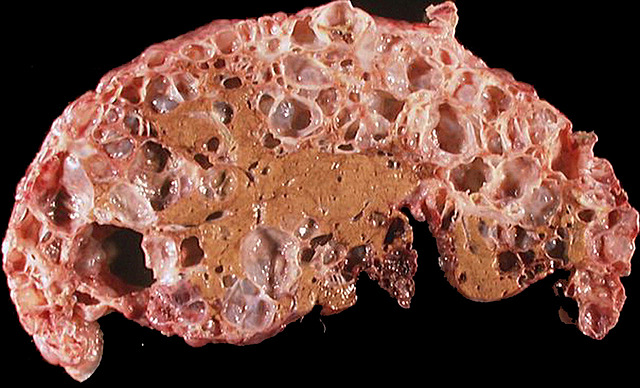 Plastico: el causante de la muerte de mas de 3500 millones de personas