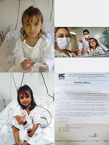 Transplante da minha Irmã