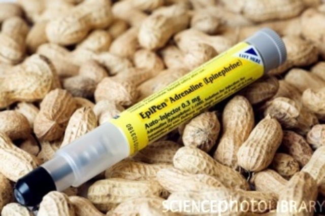 My allergies DISCOVERED