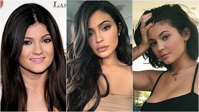 First plastic surgery