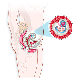 Diàmetre del primer mes