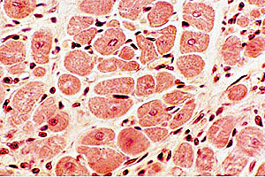 Marcello Malpighi- Nehemiah Grew