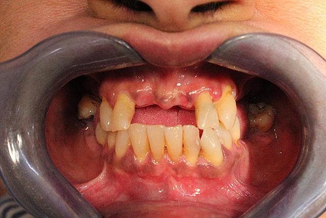 Fotografías intraorales y extraorales