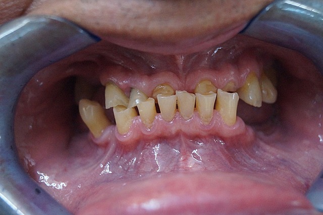 Fotografías intraorales y extraorales.