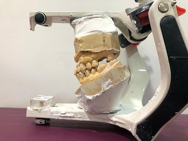 Prueba de articulado