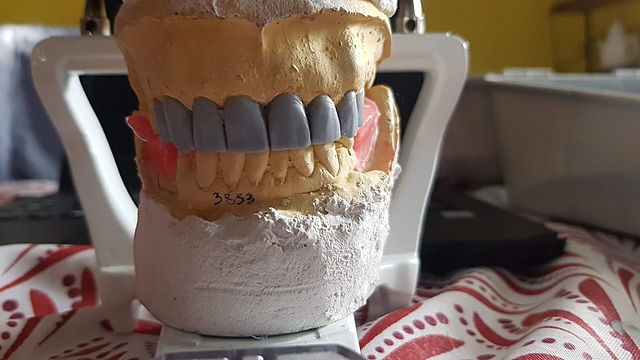 Presentación del encerado dental