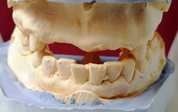 IMPRESIONES ANATÓMICAS III