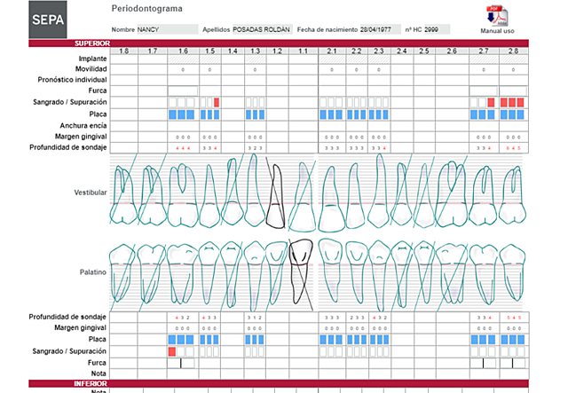 SONDEO PERIODONTAL