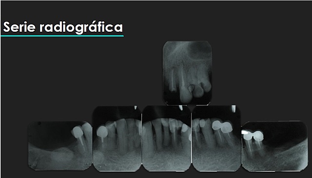 Serie radiográfica