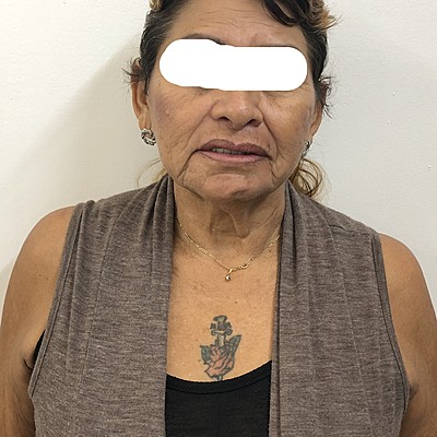 Timeline: Actividad 7