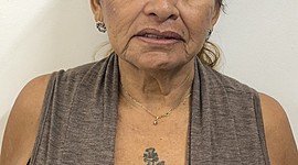 Timeline: Actividad 7