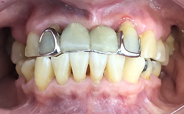 Análisis intraorales y extraorales.