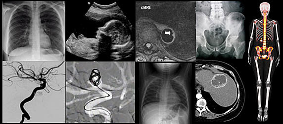 Radiology Modalities of today