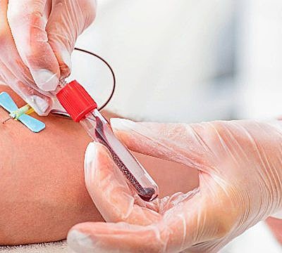 Reducción en la tasa de trasmisión del SIDA (VIH)