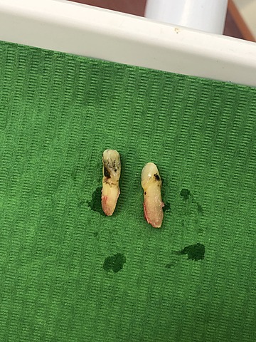 Extración de OD 1.2 y 2.2