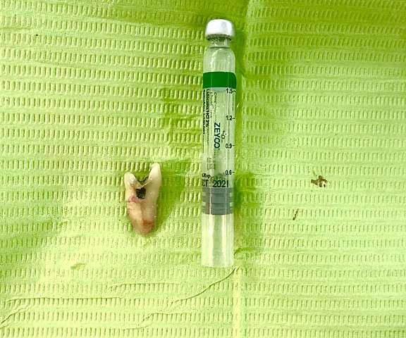 Extracción de el OD 2.4