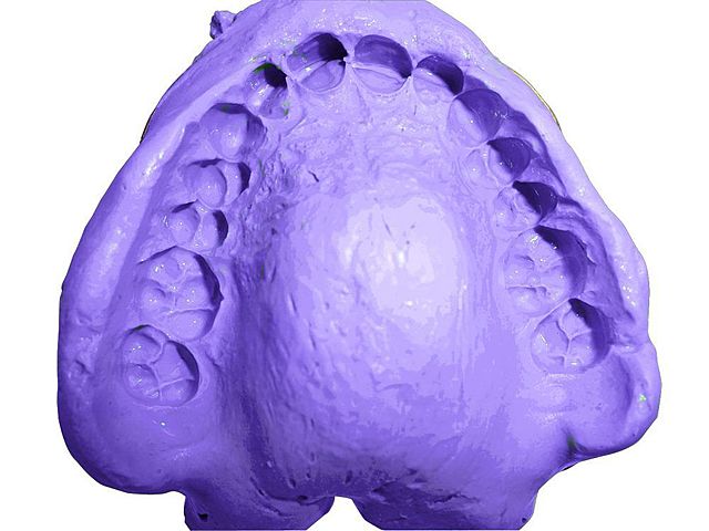 Impresiones y articulado.