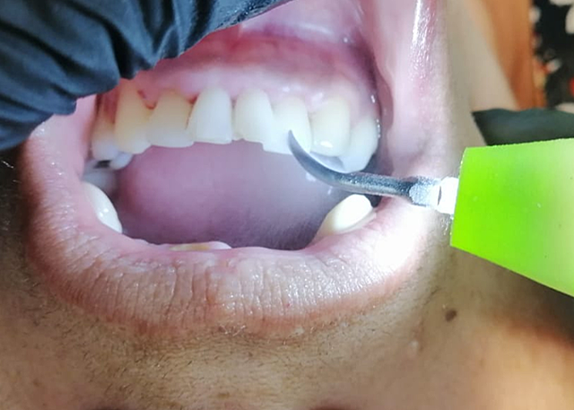 FASE HIGIENICA (PROFILAXIS)