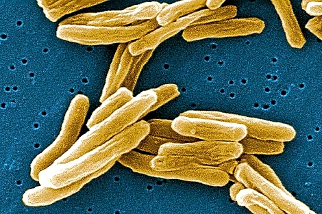 Bacilo de la tuberculosis