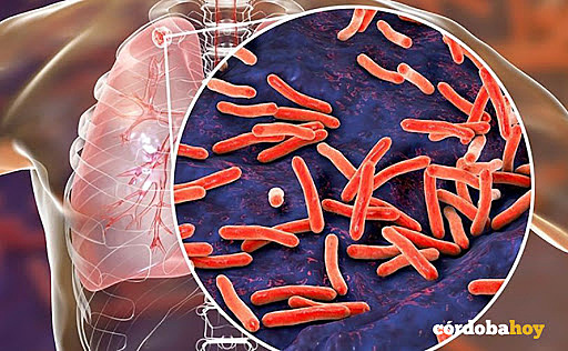 BACILO DE LA TUBERCULOSIS