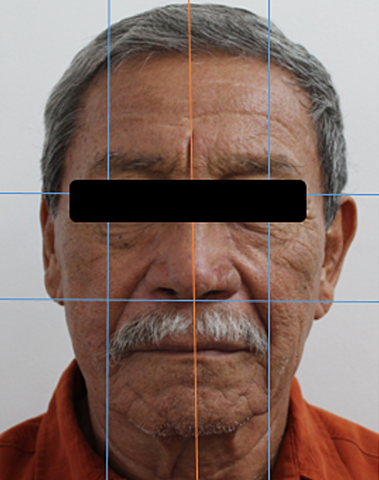 FOTOGRAFÍAS INTRAORALES Y EXTRAORALES