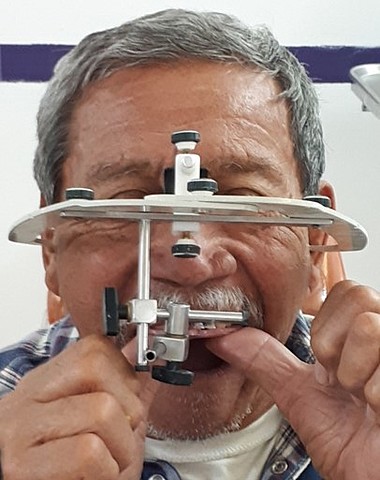 ARTICULADO DEL PACIENTE