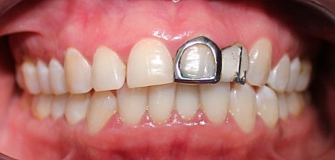 Analisis intraoral y extraoral.