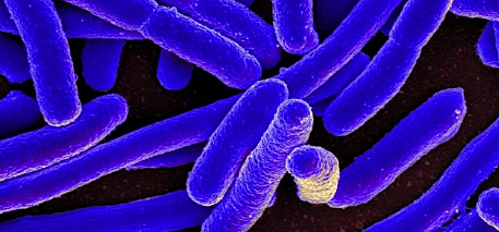 E. Coli