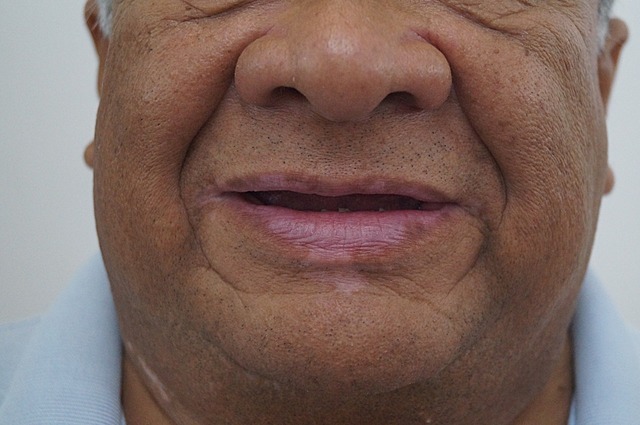 Fotografías extraorales