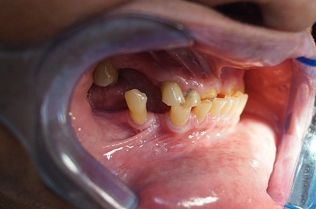 Fotografías intraorales