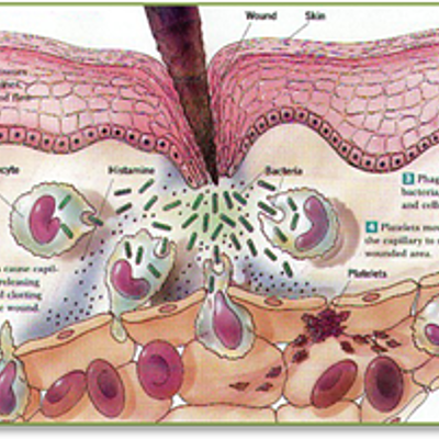 Timeline: Inflamación