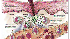 Timeline: Inflamación