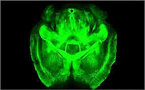CLARITY, la técnica de 'hacer transparente' el cerebro para ver su estructura molecular