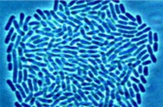 Discovery that Extra Chromosome Causes Down's Syndrome