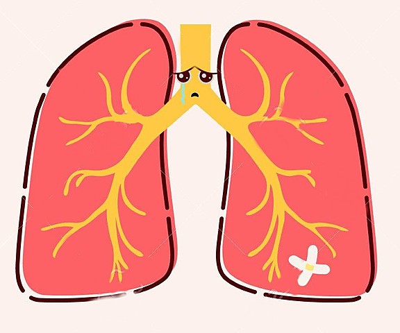 Mycobacterium tuberculosis was discovered by Robert Koch
