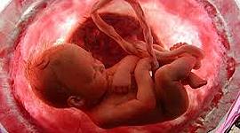 Timeline: Linea de tiempo Gestacion