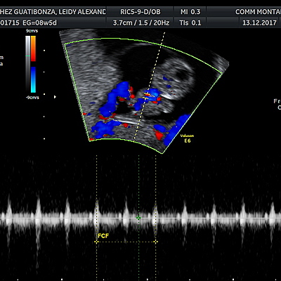 Timeline: POSITIVO un sueño hecho realidad