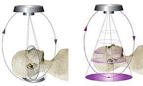 Escáner haz de abanico