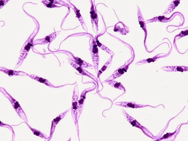 Enfermedad de Chagas