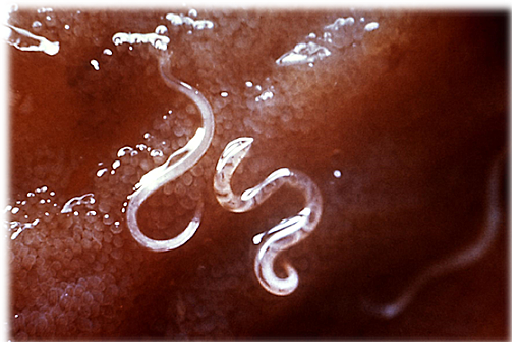 Ancylostoma duodenale