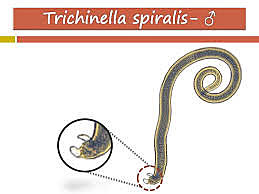 Trichinella spiralis