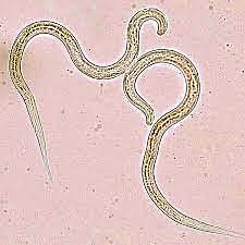 Strongyloides stercoralis